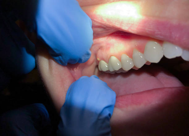 Best Emergency Denture Repair in Scottdale, PA