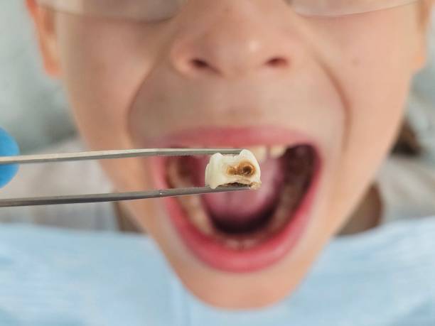 Best Emergency Care for Gum Disease in Scottdale, PA